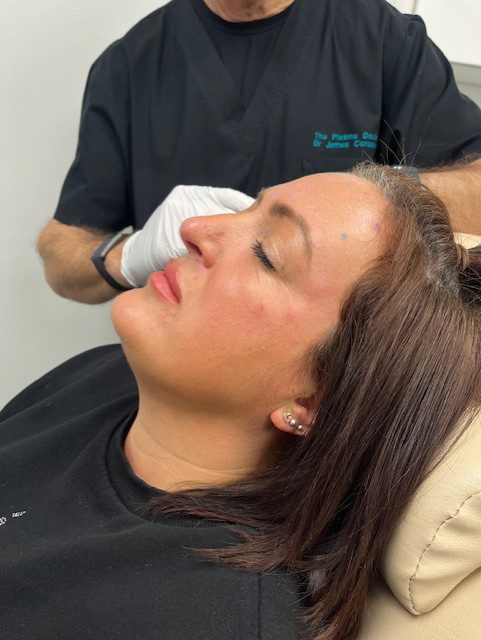Dermal Fillers