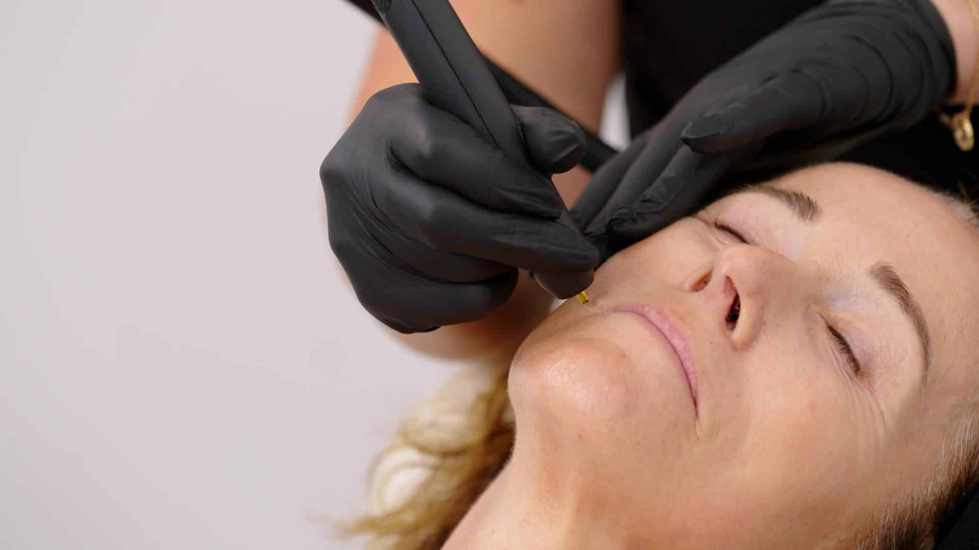 conditions-hub-treatment-hero-warrington